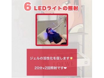 ホワイトニングショップ 津田沼店/【照射の流れ】6