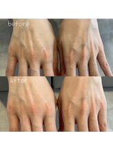 シャルム ド ネイルズ(Charm de nails)/