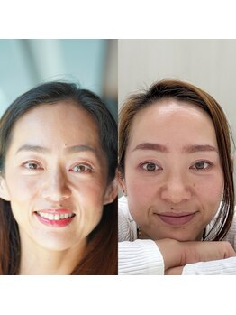 ハーモニーフィットネス 赤坂(Harmony Fitness)/シナプス療法シナプスエステ