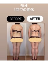 リトリート(Retreat)/施術1回での変化　