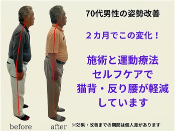 とりまる整体院 アイワイ(iy)/７０代男性の姿勢改善！