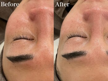 シャルム(Charme)/メンズフェイシャル♪1回の変化