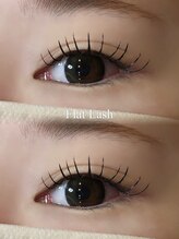 ジッピー オブ トータルビューティー アイエク(Zippy of totalbeauty iEQ)/