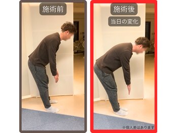 まこと整骨院/急なぎっくりな腰の当日の変化１