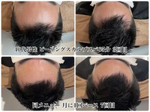 ミルラ(myrrh)の雰囲気(お客様ビフォーアフターを公式HPに掲載中!https://myrrh.tokyo/)