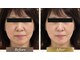 ベルーチェ(Beluce)の写真