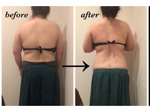 リズ(Liz)/痩身エステ