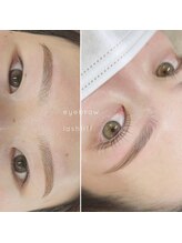スーコ アイビューティー(suco)/セットメニューが人気！