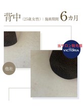 エムズスタイル ネイルバー(M's Style NAIL BAR)/背中脱毛