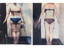 パーフェクトボディプレミアム 大阪心斎橋店(PERFECT BODY PREMIUM)/お客様　ビフォーアフター（28）