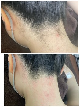 エン(en.)/BeforeAfter写真39