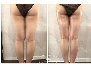 美極 トータルビューティー(美極 TOTAL BEAUTY)/恵比寿/痩身エステ