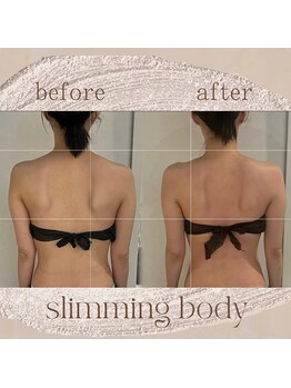 サロン ド ブラン アオヤマ(Salon de BLANC AOYAMA)/痩身メニューbefore・after