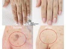 ネイルラボ レモンツリー(Nail Lab LEMON TREE)の雰囲気（手のお悩み全てが改善。若々しい見た目を目指せるトリートメント）
