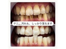 ホワイトニングショップ 岸和田店の雰囲気（タバコのヤニ汚れやコーヒーの着色も綺麗に落ちます★）