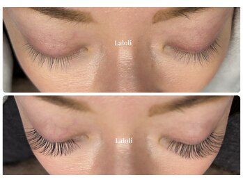 ラロリ(Laloli)/【バインドロック】100束コース