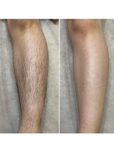 ナチュラヒルズ(Naturahills)/