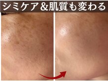 トータルビューティー ココ(Total Beauty CoCo)