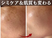 トータルビューティー ココ(Total Beauty CoCo)