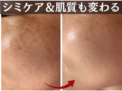 トータルビューティー ココ(Total Beauty CoCo)の写真