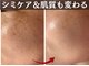 トータルビューティー ココ(Total Beauty CoCo)の写真