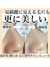 ピュール 鯖江店(PUR)/毛穴サロン/毛穴ケア/毛穴洗浄