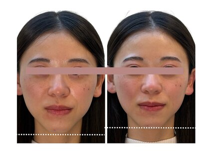 東麻布アマン(東麻布Aman)の写真