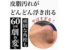 エモーションプラス(Emotion plus)/人気・毛穴洗浄専用機器◎