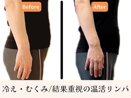 ウルーズ(HRUREUSE)の写真