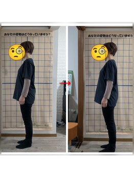 カイロプラクティック 楓/姿勢改善　例