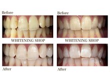 ホワイトニングショップ 西原店の雰囲気(お子様連れOKでお忙しい方でも通いやすいホワイトニング専門店♪)