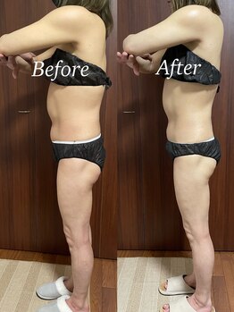 ヴィム(VIM)/ハイパーナイフビフォーアフター