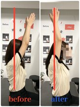 ナオル整体 新宿院(NAORU整体)/20代女性-猫背矯正3ヶ月経過