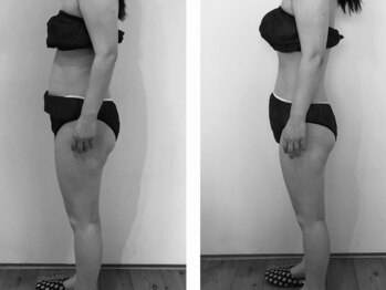 レーヌ(Reine)/デトックスコース