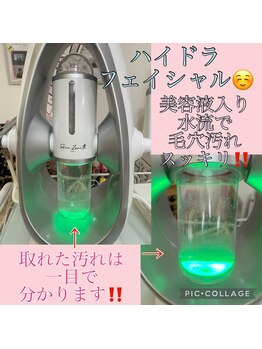 ジュネル ローズ(JEWNEL ROSE)/取れた汚れが目に見えます！！