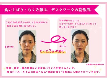 理想の小顔 福島店/小顔矯正と骨盤矯正が同時に?!