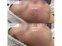 サロンドブランシール(salon de blanchir)の雰囲気（毛穴レスな肌が実現！もう悩むのはこれで最後にしよう）