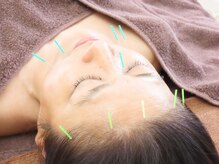 アクアマナ(AKUA. MANA)の雰囲気（人気メニュー！巡りを整えむくみケア☆小顔美容鍼♪）