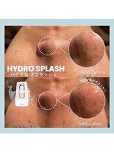 フルアナ(Hu ruana)/フェイシャルエステ