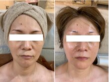 ナトラ 蔵前/60前半エイジングケア複合型