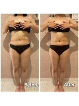 エミア(Emia)/全身痩せ×歪み改善◎120分 １回