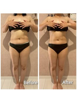 エミア(Emia)/全身痩せ×歪み改善◎120分 １回