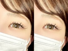 目力抜群！【ダブルフラットラッシュ】！！