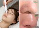 チュララ(Churara)の写真/毛穴汚れごっそり！都度払いOK【韓国式♪ハイドロ毛穴洗浄体験★60分¥4980】黒ずみ・角栓を浮かせて吸引♪