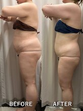 ベルミーランド MEGAドン・キホーテ草加/痩身BeforeAfter
