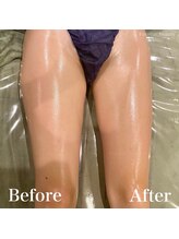 モット 神戸店(Motto)/脚全体痩身