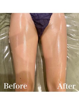 モット 神戸店(Motto)/脚全体痩身