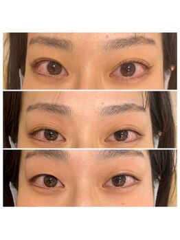 カラフェリズ(Carafeliz)/ダブルアイリフト