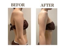 ルアバイアロ(Lua by Alo's)/一目瞭然！上半身痩せ！