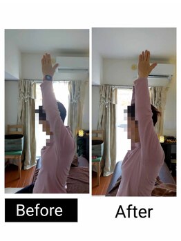 アース エンジェル整体院/ビフォアフ 肩こり ストレッチ